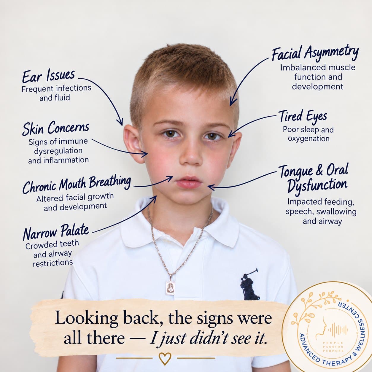 Annotated photo of Michael as a young boy with labels pointing to ear issues, skin concerns, chronic mouth breathing, narrow palate, facial asymmetry, tired eyes, and tongue and oral dysfunction